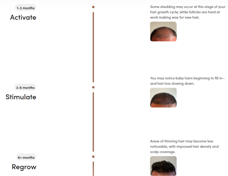 Hair Loss & Hair Regrowth Welcome Kit, Program, Pre & Post Care ...